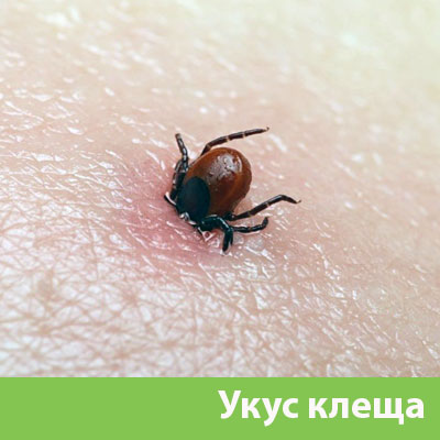 Укус клеща в Новороссийске
